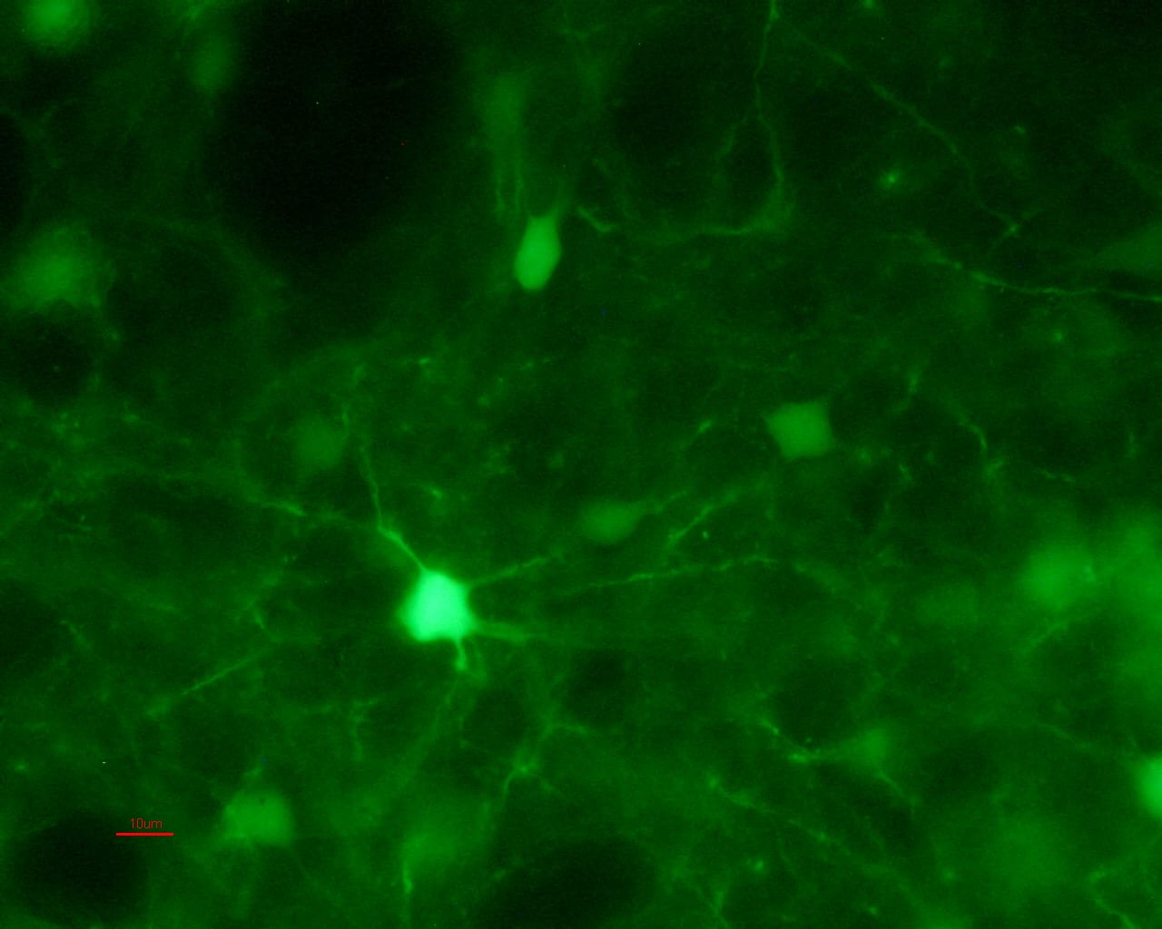 Fluorescent microscopy image of neurons