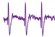Extracellular neural signal waveform